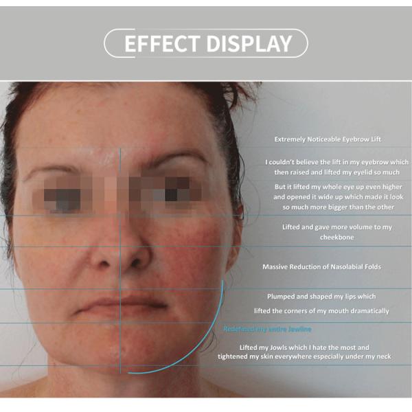 Handheld Ultrasonic Cavitation Machine , 100W 40khz Cavitation Radio Frequency Machine