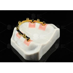 Buy cheap Titanium Sandblasted Implant Locator Bar Silver Gold Dental Implant Locator from wholesalers