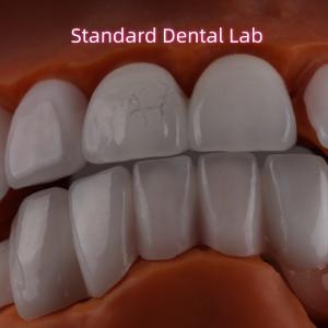 Quality Lithium Dicilicate layer Ivoclar Emax Zirconia Laminate Veneers Translucent OEM ODM for sale