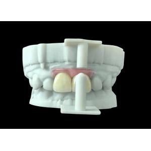 Translucency Zirconia Dental Crown with Aesthetic Performance from China Dental