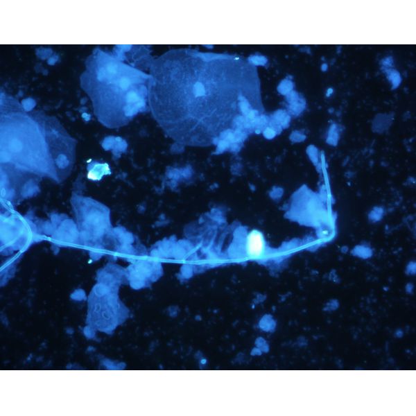 200 Tests Fungal Fluorescence Stain Two Steps Method For Hospital