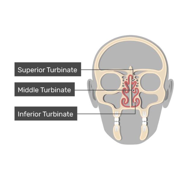 Mechan Plasma ENT Probe for Tubinate Channeling and Ablation