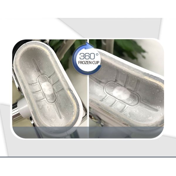 OEM Portable Cryolipolysis Machine , Cryo Weight Loss Machine 200W