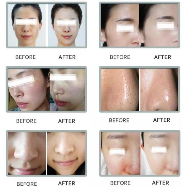 Vertical Multifunctional 8in1 Hydro Oxygen Machine H2O2 Skin Care Deep Cleaning