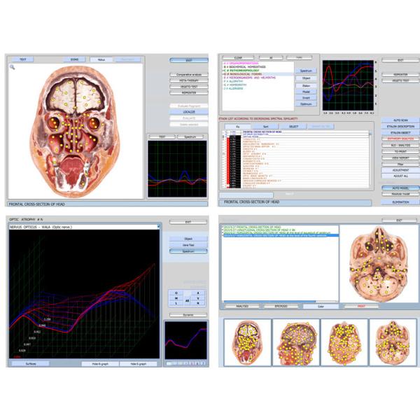 9D NlS Health Analyzer Magnatic Resonance Imaging Full Body Diagnostic System