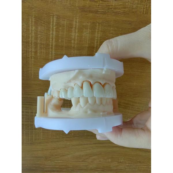 Translucent Layered Zirconia Crown Dental Restoration Multilayer Zirconia Crown