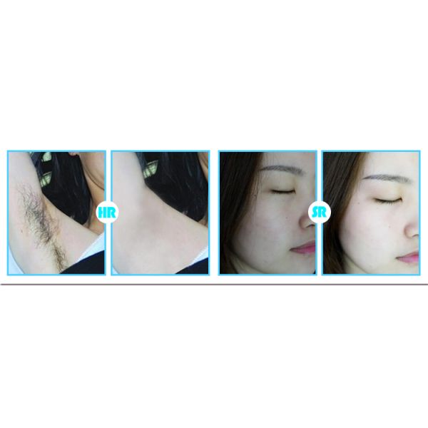 CE Approval IPL Hair Removal Machine for Home Use