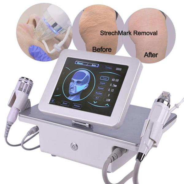 Portable RF Radio Frequency Machine Microneedling Fractional Stretch Marks
