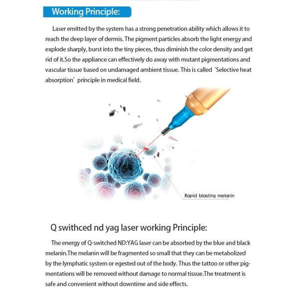 tattoo removal machine