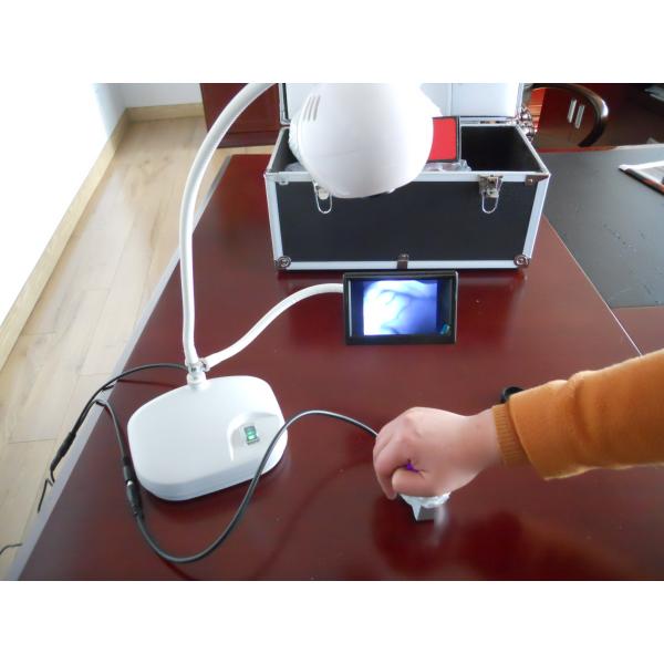 Lamp To Display Veins Vein Locator Device Improves Staff Efficiency