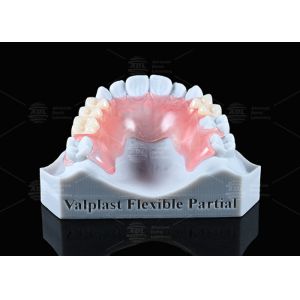 Natural Looking Valplast Partial Denture Longevity Highly Resistant To Fractures
