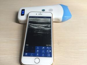 Quality New products Phone / Android wireless USB probe mobile phone ultrasound for clinic for sale