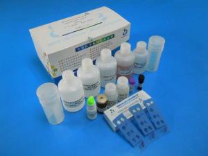 Quality Male Infertility Sperm Function Test Kit For Evaluating The Acrosome Function for sale