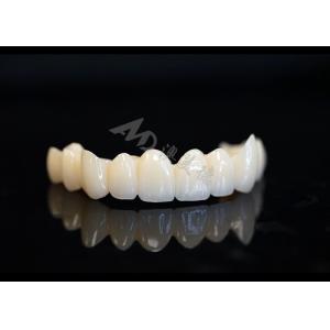 Quality Precision Made Solid Zirconia Crown For Perfect Dental Fit And Comfort for sale