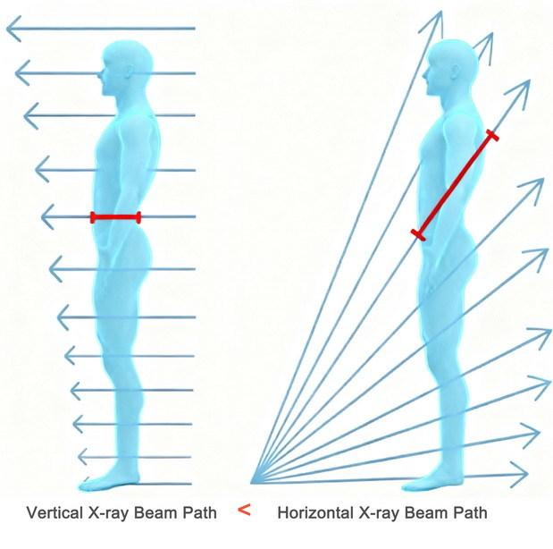 Dual View Security Body Scanner Quick Deployment Compact Design