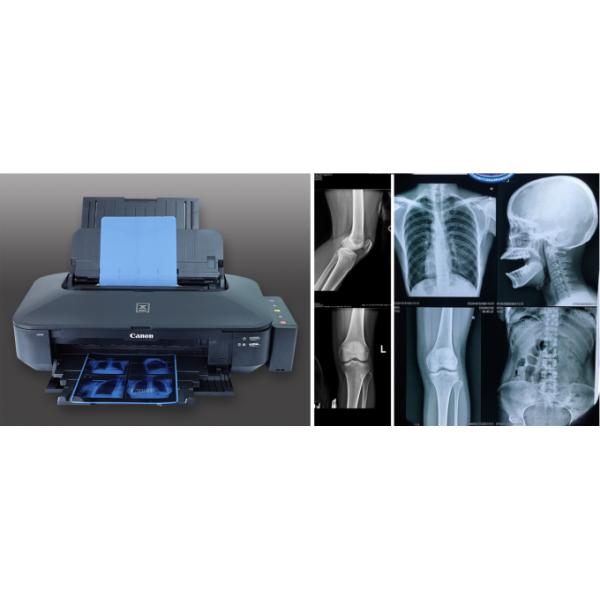 High Grade Roll Blue Laser Printing Medical X Ray Imaging Film