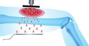 Tecar Diathermy Monopolar RF Tecar Physical Therapy Machine