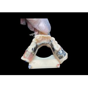 Quality Easy Maintenance Cast Partial Dentures for Superior Strength and Aesthetic Appeal for sale