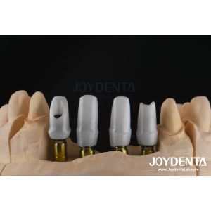 Quality Custom Dental Implant Zirconia Abutment For Single Or Multiple Unit Restorations for sale