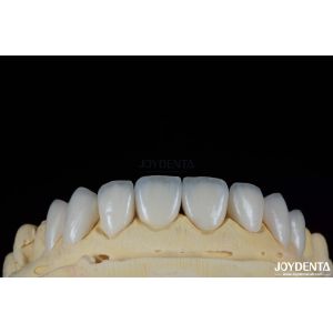 Buy cheap Long-lasting And Stain Resistant Dental Veneers With Personalized Shades For from wholesalers