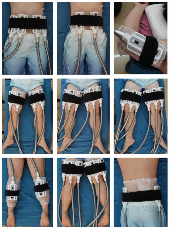 T Shock Cryolipolysis Slimming Machine Thermal Multifunction Cryolipolysis Machine