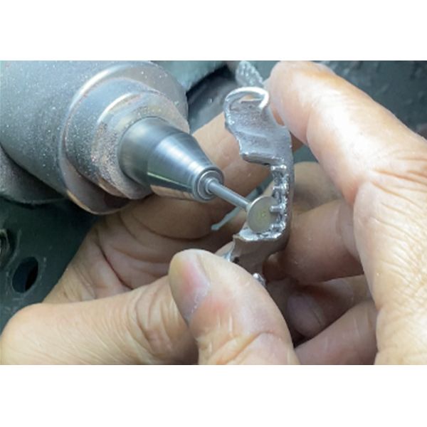 Easy-to-Clean Custom Cast Partial Dentures Ideal for Restoring Chewing Ability and Smiles