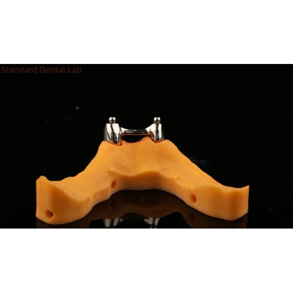 Ivoclar Digital Dental Implant Bar Denture with Attachments , Full Acrylic Titanium Implant Supported Dentures